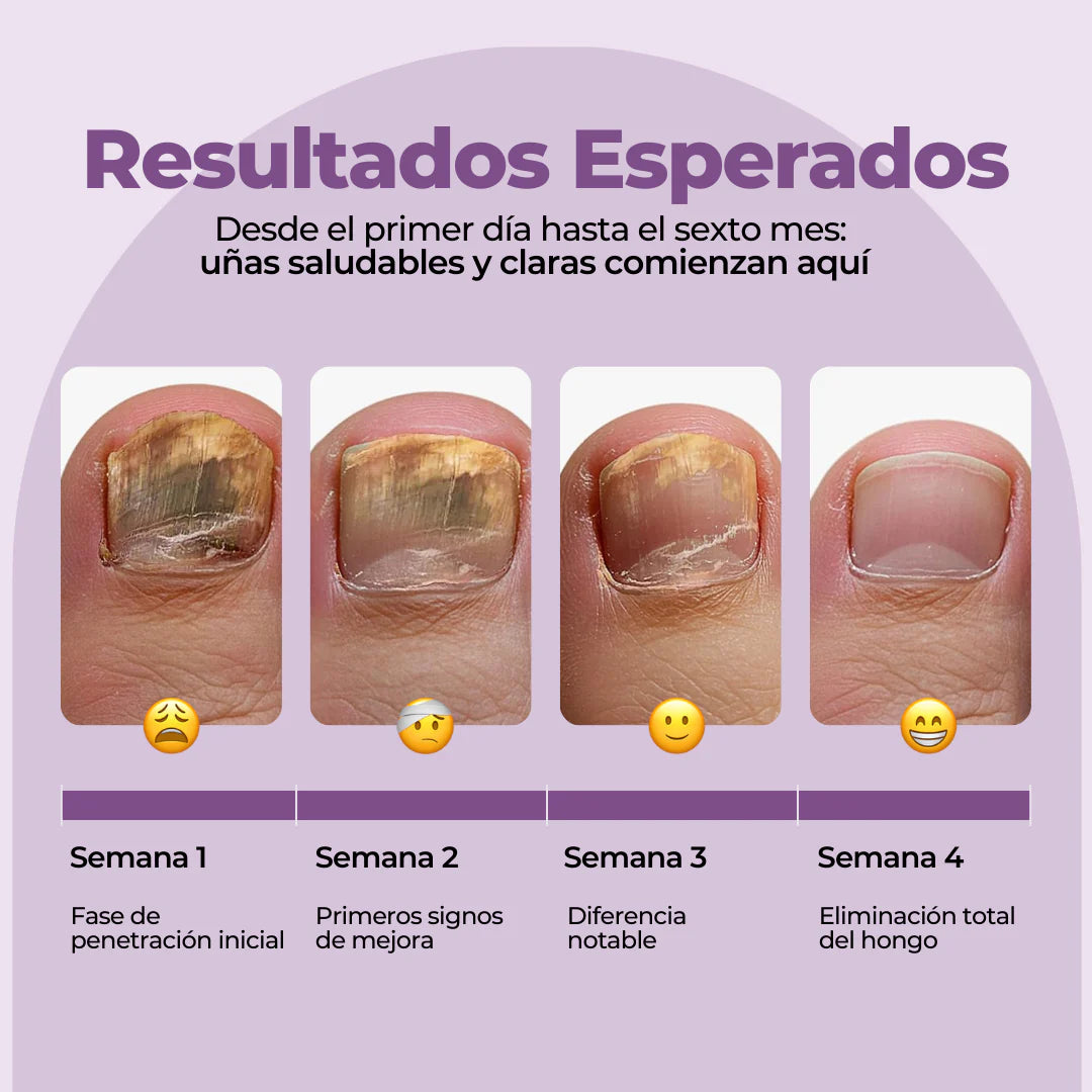 7 Days | Elimina hasta el 99.9% de los hongos en tus uñas.
