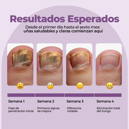 7 Days | Elimina hasta el 99.9% de los hongos en tus uñas.